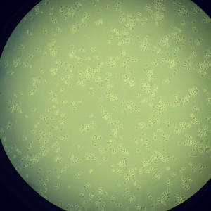 Photo of macrophages in a hydrogel through a microscope