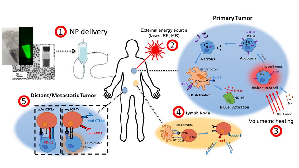 Nanoparticle + laser = cancer treatment