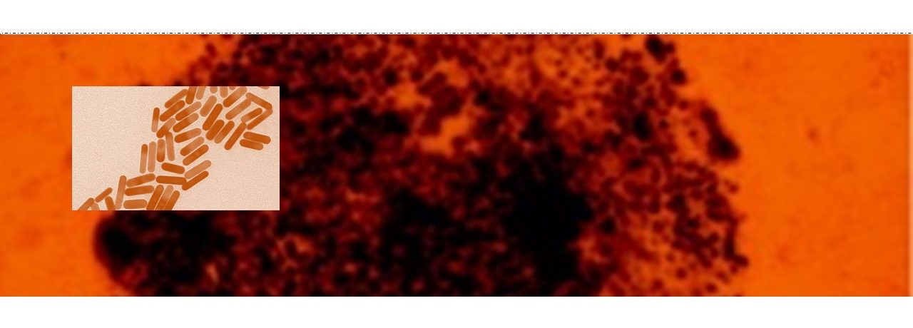 Nanoparticle + laser = cancer treatment