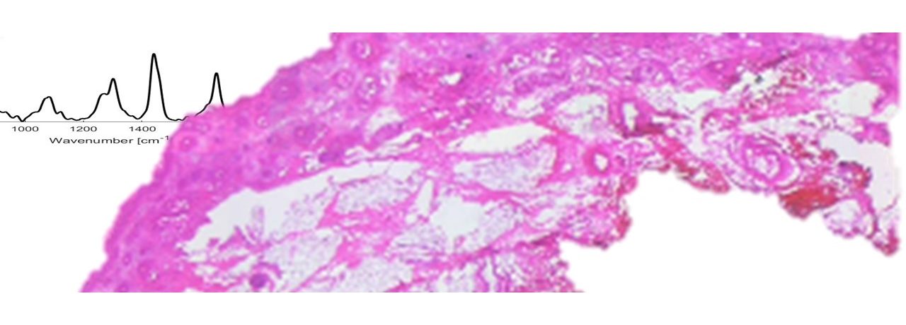 Image-guided surgery using Raman microscopy