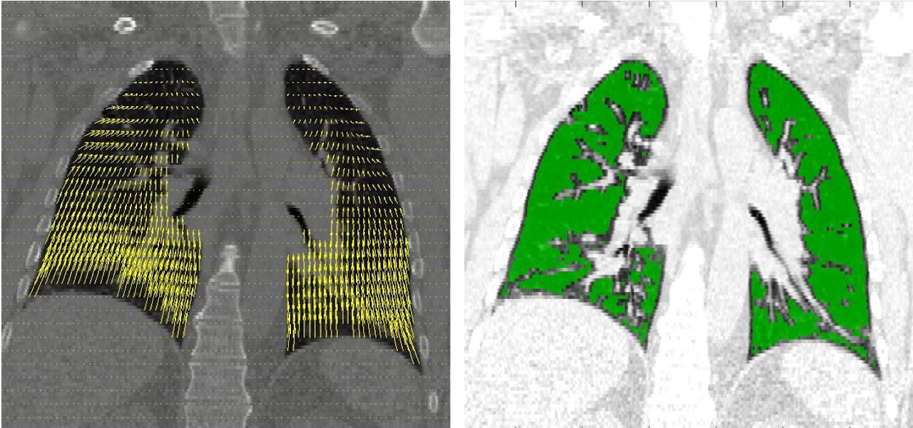 Medical Image Processing The Dynamic Medical Image and Computing Lab