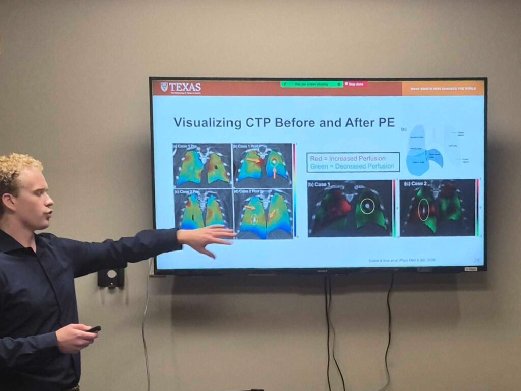 Blake Evans presenting his PhD proposal on visualizing CT perfusion before and after pulmonary embolism
