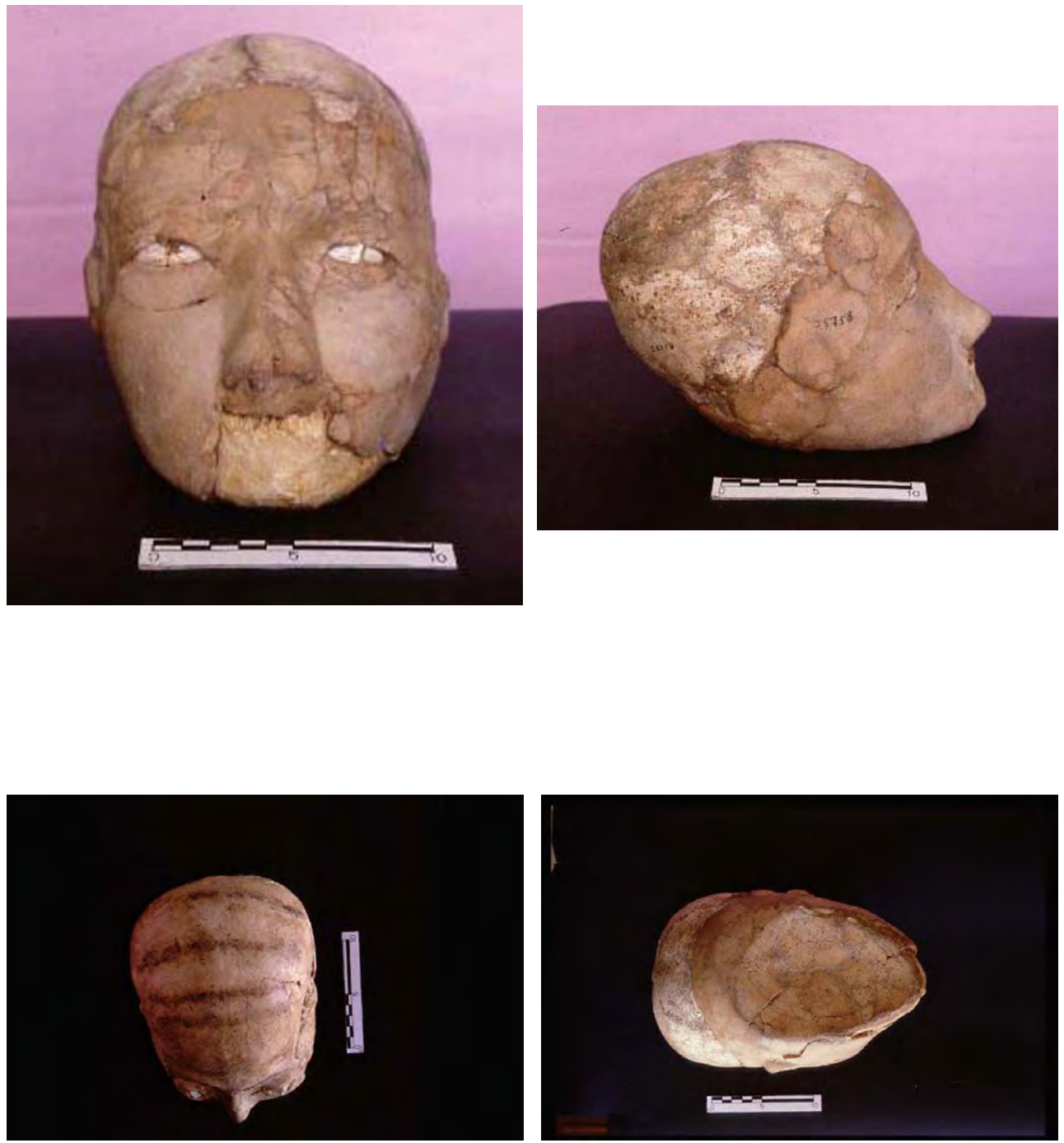 four photographs skull at different angles.