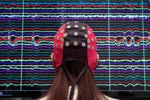 Scientists have studied how brain–computer interfaces, such as this non-invasive cap, change brain activity. Credit: Silvia Marchesotti