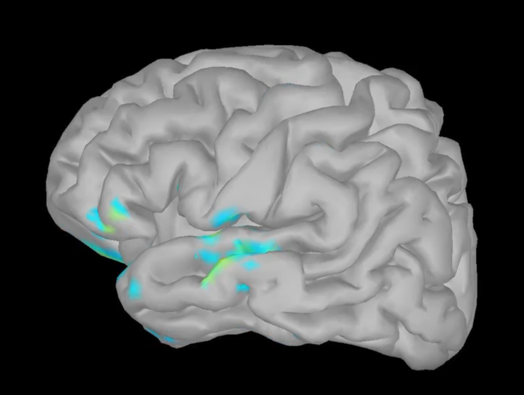 Against a black background, a gray image of a human brain shows several parts lit up in bright turquoise blue and lime green.