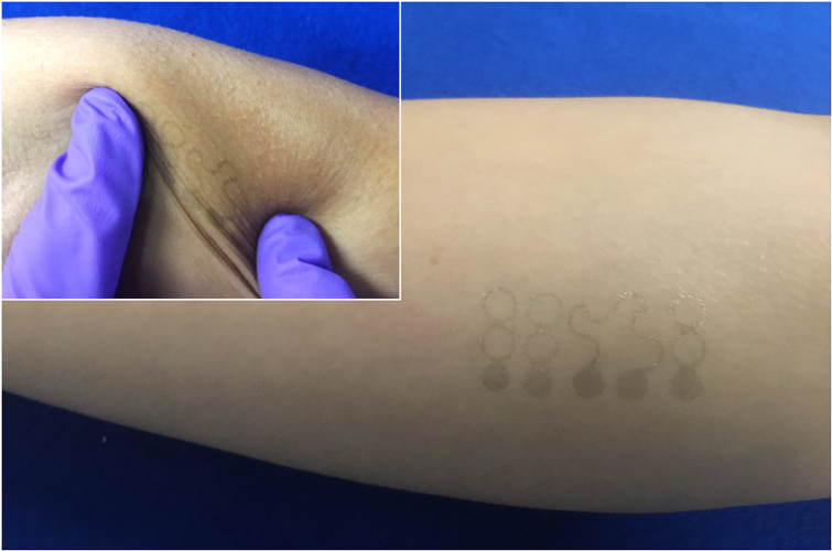Graphene electronic e-tattoo (GET) as imperceptible wearable sensors