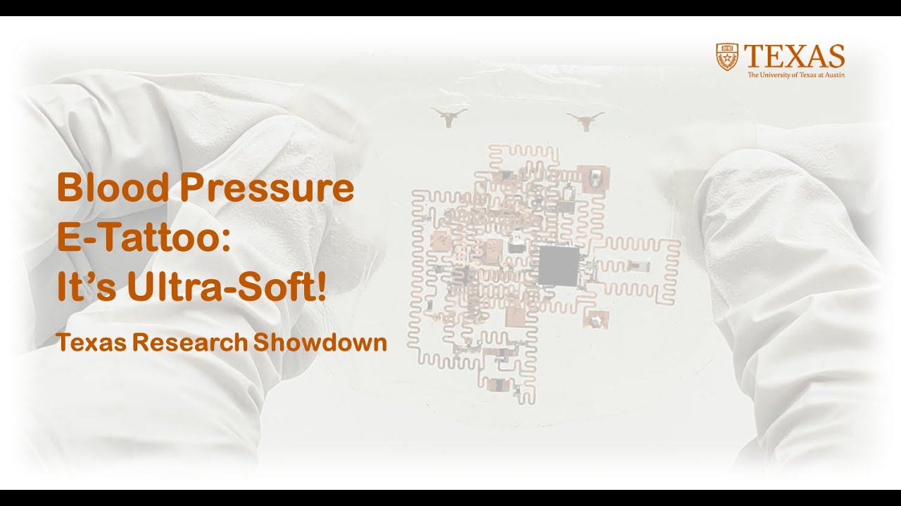 Congratulations to Philip!