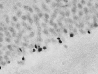 Latent reactive neurogenesis (NeuroD)