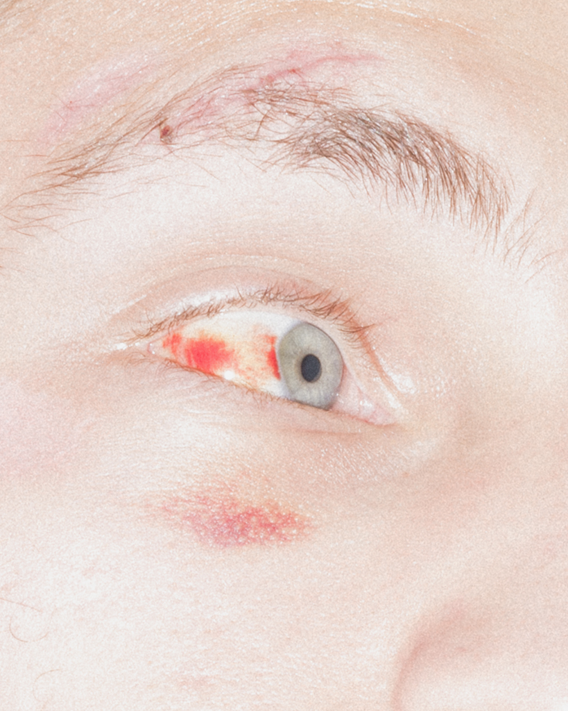 close-up of bloodshot human eye