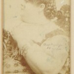 Ada Briggs Ada Briggs worked for Barnum for many years and weighed more than 500 lbs. Her arm measured 34” around. She later went on to become the president of a convention of fat women held in Baltimore.