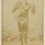 Lallo (sic)Born in 1874 in Oovonin, Oudh, Lalloo had a parasitic twin brother attached to his body by the neck. Lalloo shared a circulatory and nervous system with the twin and could feel whenever it was touched. He was very successful and was often hailed as "very handsome." Lalloo died in 1905 when he was just thirty-one years old.