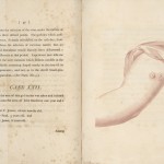 Page 40 from “An Inquiry into the Causes and Effects of the Variolae Vaccine” by Edward Jenner, 1798. In the 22nd case study, Jenner’s 11-month-old son Robert was inoculated along with two other young children.