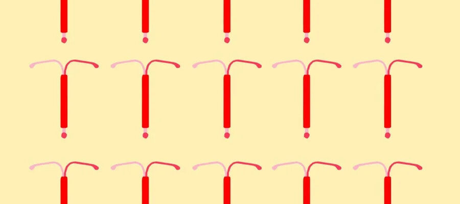 A Guide to IUDs 