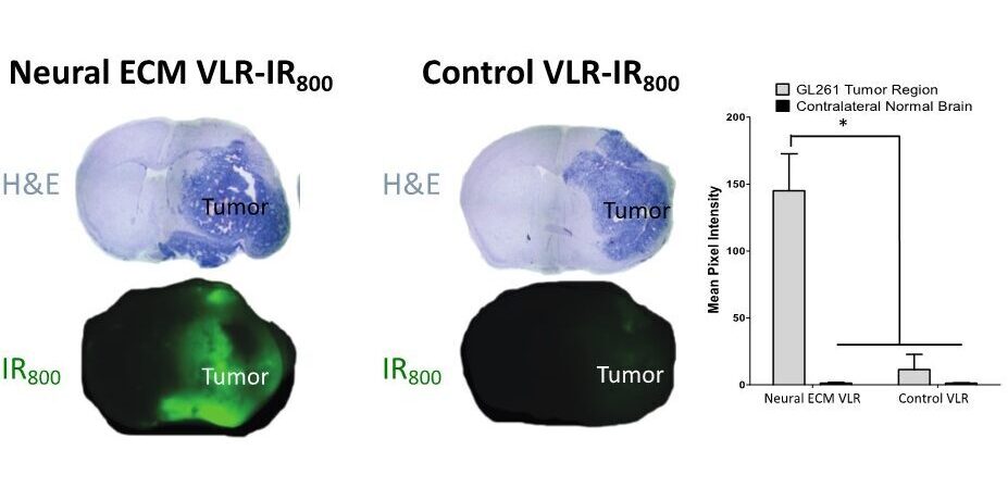 Targeting Neuropathologies via Blood-Brain Barrier Disruption