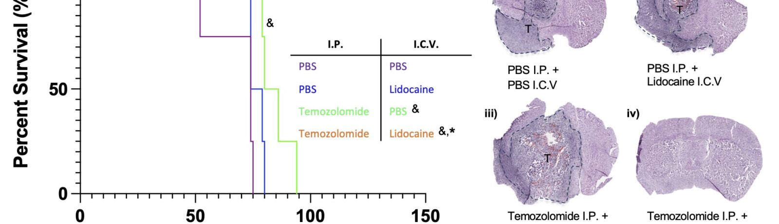Altering Parenchymal/Cerebrospinal Fluid Flux